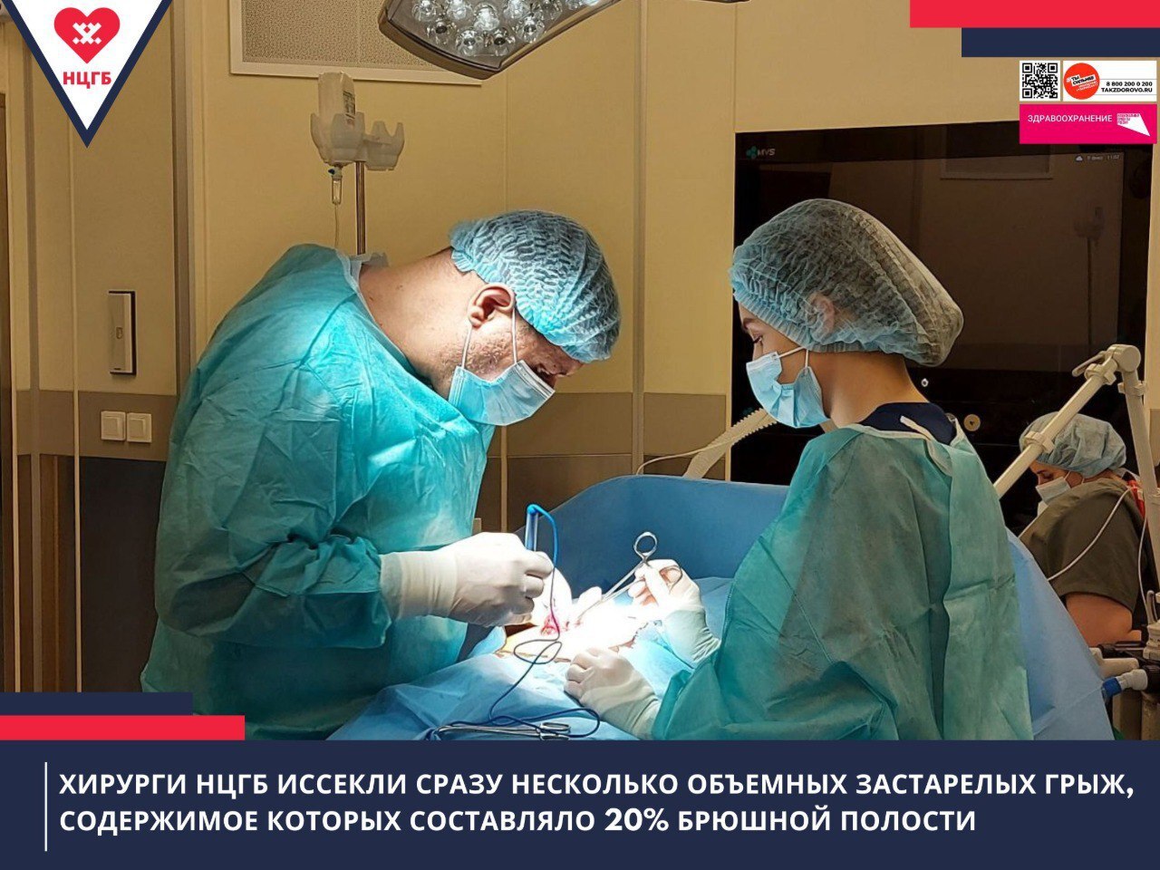 Получив множественные травмы органов брюшной полости в ДТП, мужчина перенес несколько сложных операций Спустя время по ходу постоперационных рубцов сформировались вентральные грыжи - это патологическое состояние, когда часть внутренних органов выходит под кожу сквозь дефекты хирургических разрезов. У мужчины большая срединная грыжа, 2 боковые и ещё одна поясничная. В целом грыжевое содержимое составляло 20% объёма брюшной полости. Во время первого этапа открытой операции хирург Василий Артым вправил грыжевое содержимое в брюшную полость, удалил грыжевой мешок, ушил дефект и выполнил абдоминопластику – иссек излишки кожно-жирового слоя. Это заняло чуть больше часа. Следующий этап операции будет проведен через несколько месяцев – предстоит ушить дефект в поясничной области, он меньших размеров, но осложнен тем, что глубоко расположен. Уже сейчас мужчина чувствует себя гораздо лучше: исчезли боли, одышка, наладилась работа внутренних органов.