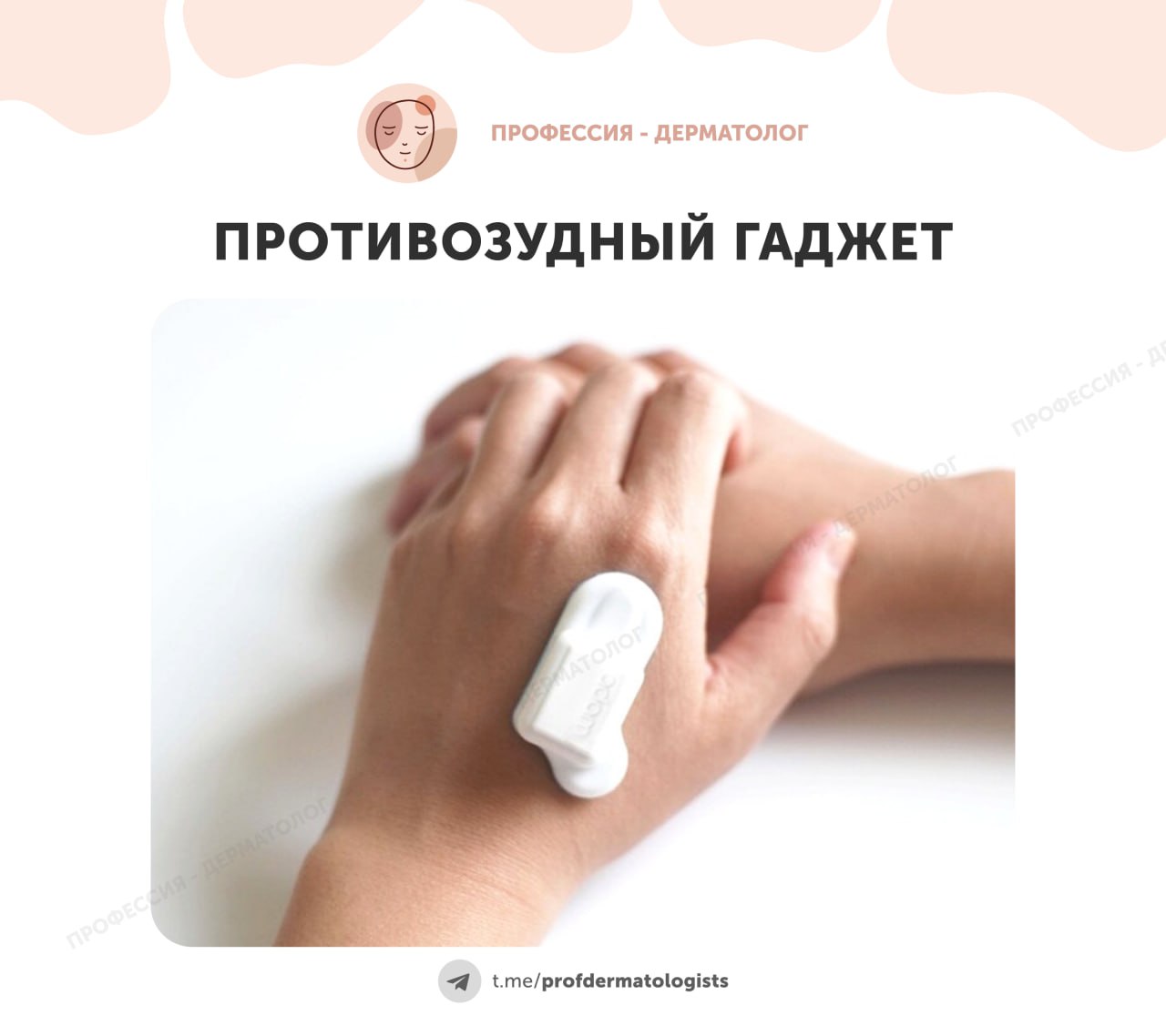 Противозудный гаджет с ИИ  Американская компания Sibel Health в сотрудничестве с японской Maruho готовится к коммерческому выпуску портативного устройства, которое помогает пациентам с дерматитом уменьшить зуд и предотвратить повреждение кожи.  Гаджет Adam крепится на кожу и использует искусственный интеллект для предсказания момента, когда человек собирается почесаться. В этот момент устройство начинает вибрировать с высокой частотой, создавая ощущение облегчения без травмирования кожи.  ИИ анализирует движения пользователя и с точностью до 99% предсказывает желание почесаться. Гаджет вибрирует до 10 000 раз в минуту, обманывая нервную систему.  Исследования показали, что после 100 дней использования устройства:    Число царапин на коже сократилось на 33%.   Желание чесаться уменьшилось в два раза.  Устройство уже получило одобрение FDA в США. Теперь, благодаря партнёрству с Maruho, оно выйдет на рынок Японии, где атопический дерматит распространён особенно широко.   Как вам идея такого гаджета?