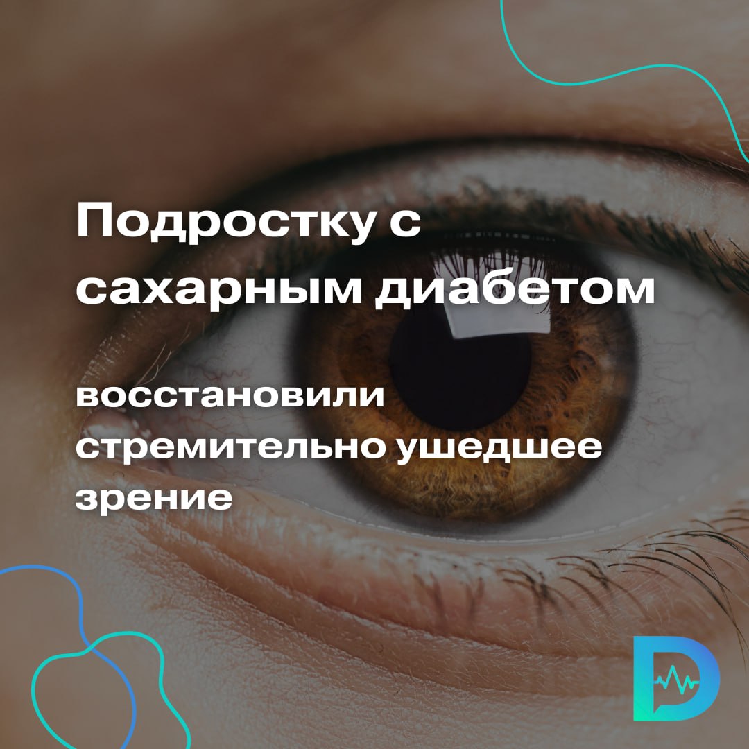 Сахарный диабет первого типа у 16-летней жительницы Подмосковья дал тяжёлое осложнение: она совсем перестала видеть. И случилось это просто стремительно — всего за три месяца.  Ослепшего подростка с сахарным диабетом доставили в подмосковный Детский клинический центр им. Л. М. Рошаля. Как говорят врачи, случай уникальный: полная слепота на фоне болезни произошла слишком быстро. Девушка больше не могла сама передвигаться, постоянно нужна была помощь родных.  Чтобы изменения не стали необратимыми, девушке требовалась срочная и сложная операция — факоэмульсификация. Команда офтальмохирургов и эндокринологов Центра Рошаля удалили пациентке набухавший хрусталик, а вместо него имплантировали интраокулярную линзу с углубленным фокусом.  По словам Леонида Кононова, заведующего отделением микрохирургии глаза, после этой операции юная пациентка сможет не просто видеть, а избавиться от имеющейся близорукости и видеть всё вокруг без очков. Подобранная линза должна восстановить девушке стопроцентное зрение.  «Операция прошла успешно, уже на следующий день, сняв повязку, пациентка вновь увидела мир. Её радость стала лучшей наградой для нашей команды»,  — добавил Леонид Кононов.  Как отмечают в министерстве здравоохранения Московской области, сейчас подросток пока ещё в больнице, но уже готовится благополучно вернуться домой.  «Доктор Питер». Доступно и достоверно о здоровье