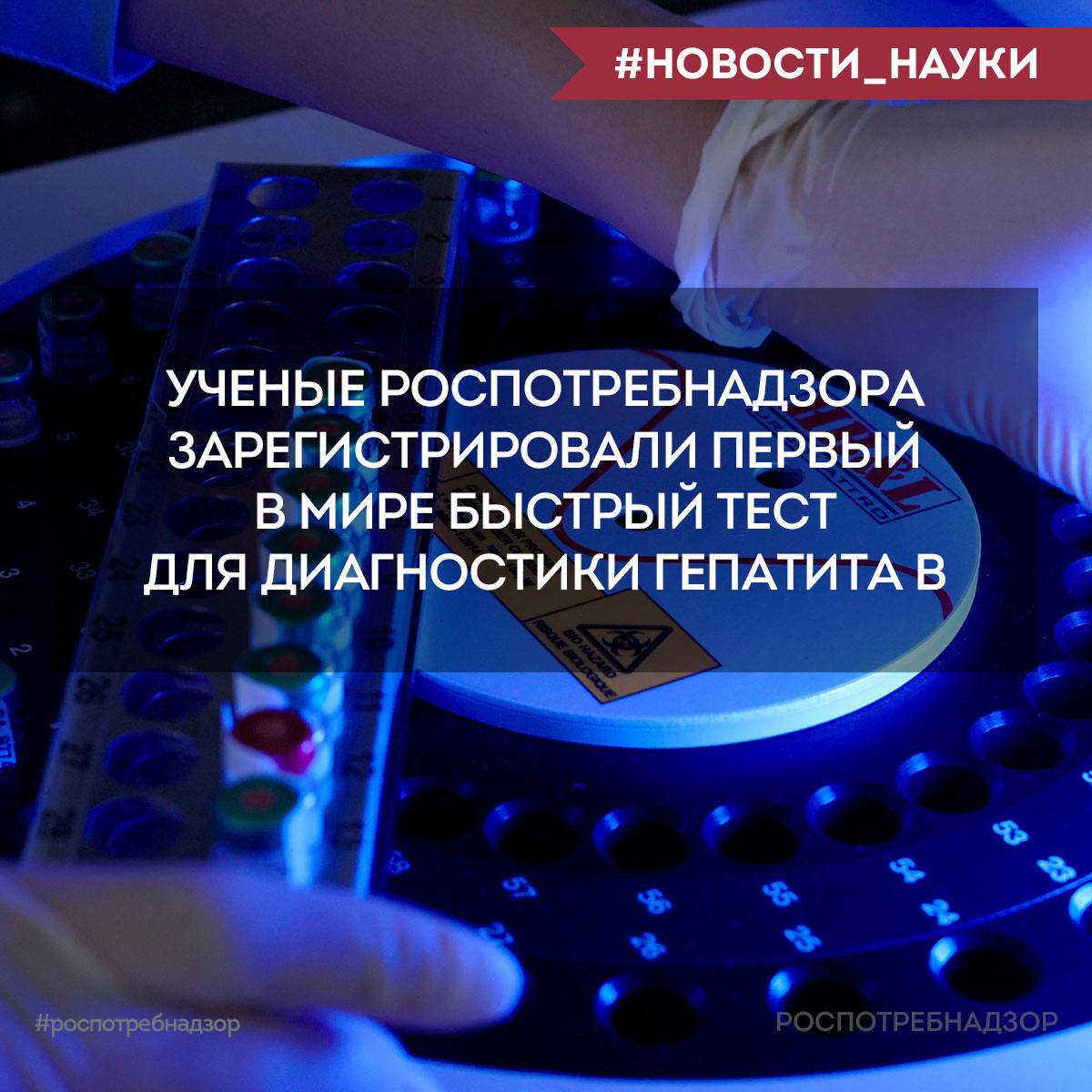 Роспотребнадзор VK Первый в мире быстрый тест для диагностики гепатита В Ученые ФБУН ЦНИИ Эпидемиологии Роспотребнадзора зарегистрировали первый в мире быстрый тест для диагностики вирусного гепатита В на основе петлевой изотермической амплификации LAMP Гепатит В это инфекционное заболевание которое может привести к тяжелым поражениям печени включая цирроз и рак Инфекция передается через кровь и другие биологические жидкости особенно уязвимыми являются дети и люди с ослабленным иммунитетом Новый тест сопоставим с методом ПЦР по чувствительности но позволяет определить наличие вируса всего за 2 5 3 0 минут что значительно ускоряет процесс диагностики по сравнению с традиционными методами Тест помогает быстро и точно диагностировать болезнь Это имеет ключевое значение для оперативного выявления больных назначения эффективной терапии и принятия противоэпидемических мер Разработка проводилась в рамках Федерального проекта Санитарный щит страны безопасность для здоровья предупреждение выявление реагирование