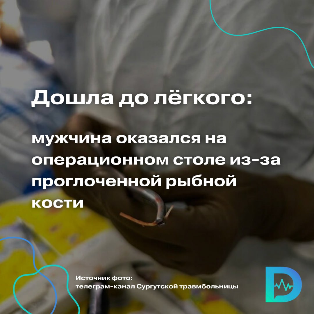 Житель ХМАО во время еды случайно проглотил рыбную кость. Дискомфорт и боль при глотании начали беспокоить 62-летнего мужчину сразу после рыбной трапезы. Однако с обращением к врачу он решил подождать, а через 3 дня у него поднялась высокая температура.  Местные врачи сделали 62-летнему пациенту компьютерную томографию и увидели, что за это время кость проткнула пищевод и мигрировала в грудную полость. Пациента срочно направили в Сургутскую клиническую травматологическую больницу.  Тем временем кость уже успела дойти до левого лёгкого и вызвала абсцесс. В итоге, чтобы извлечь кость и остановить гнойный процесс, мужчине потребовалась торакотомия — открытая операция, при которой вскрывается грудная клетка, а также удаление верхней доли лёгкого.  Изначально проблему можно было решить консервативно посредством эндоскопической манипуляции ФГДС, которую выполняют в любой поликлинике по месту жительства. Но эта возможность была упущена. Наглядный пример, почему нельзя затягивать с визитом к врачу, — объяснил в телеграм-канале травмбольницы Дмитрий Горлов, заведующий хирургическим отделением.  По прогнозам врачей, восстановление пациента не будет долгим. Но ему придётся ещё какое-то время ходить с дренажами для отведения из лёгкого скапливающейся жидкости и воздуха.  «Доктор Питер». Доступно и достоверно о здоровье