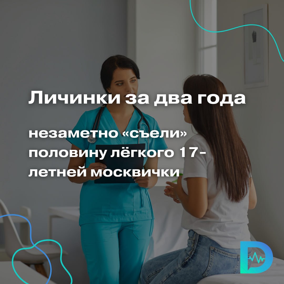 Личинки за два года «съели» половину лёгкого 17-летней москвички  Врачи случайно обнаружили у 17-летней девушки гигантскую эхинококковую кисту — мешок с личинками ленточных червей Echinococcus, который занял почти половину её левого лёгкого.  Размер образования поражал — 10×10 см, оно сдавливало здоровую ткань, затрудняя дыхание и вызывая боли в груди. За два года паразит разрушил верхнюю часть доли лёгкого, а нижнюю всё это время сдавливал,  — рассказала детский хирург Ампар Фатима из Детской больницы № 9 им. Сперанского.  Хирурги удалили кистозное образование, а после операции назначили пациентке терапию, гимнастику. Также девушке провели дополнительную диагностику, чтобы исключить поражение эхинококком других органов.  Как сообщает телеграм-канал департамента здравоохранения Москвы, сейчас девушка дышит без проблем, но ей потребуется ещё время на восстановление лёгкого.    Врачи напоминают: эхинококк долго развивается без симптомов, а заразиться можно через воду, немытые продукты или контакт с животными. В случае пациентки источником, вероятно, стали собаки, с которыми она часто играла.  «Доктор Питер». Доступно и достоверно о здоровье