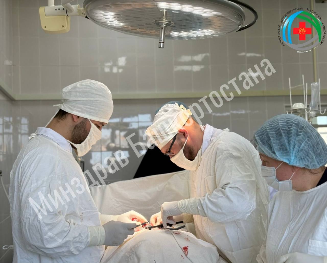 Ишимбайские нейрохирурги впервые провели декомпрессию позвоночного канала. 68-летняя пациентка обратилась в больницу с сильными болями в пояснице и левой ноге. Несмотря на проведенное консервативное лечение, которое не принесло значимого облегчения, женщина продолжала испытывать онемение и слабость в ногах, а также сталкивалась с трудностями при ходьбе. После тщательного обследования врачи выявили сужение позвоночного канала, вызванное воспалительными процессами и возрастными изменениями, что приводило к сдавлению спинного мозга. Ранее пациентов с аналогичными проблемами направляли в более крупные медицинские учреждения, в Стерлитамак или Уфу. Теперь же подобная помощь доступна в Ишимбае благодаря новому современному оборудованию и обучению специалистов в Республиканской больнице. Нейрохирургическая команда проводила операцию под контролем электронно-оптического преобразователя. Хирурги аккуратно произвели скелетаж дуг позвонков и приступили к главному этапу — гемиламинэктомии с обеих сторон, в ходе чего были удалены части костной ткани, что позволило освободить дуральный мешок и нервные корешки, которые были сдавлены и вызывали болевые ощущения. Операция прошла успешно, и уже на следующий день после вмешательства пациентка отметила значительное снижение болевого синдрома. В настоящее время она находится на этапе реабилитации и получает необходимое физиотерапевтическое лечение. #МинздравБашкортостана #СпасибоВрачам