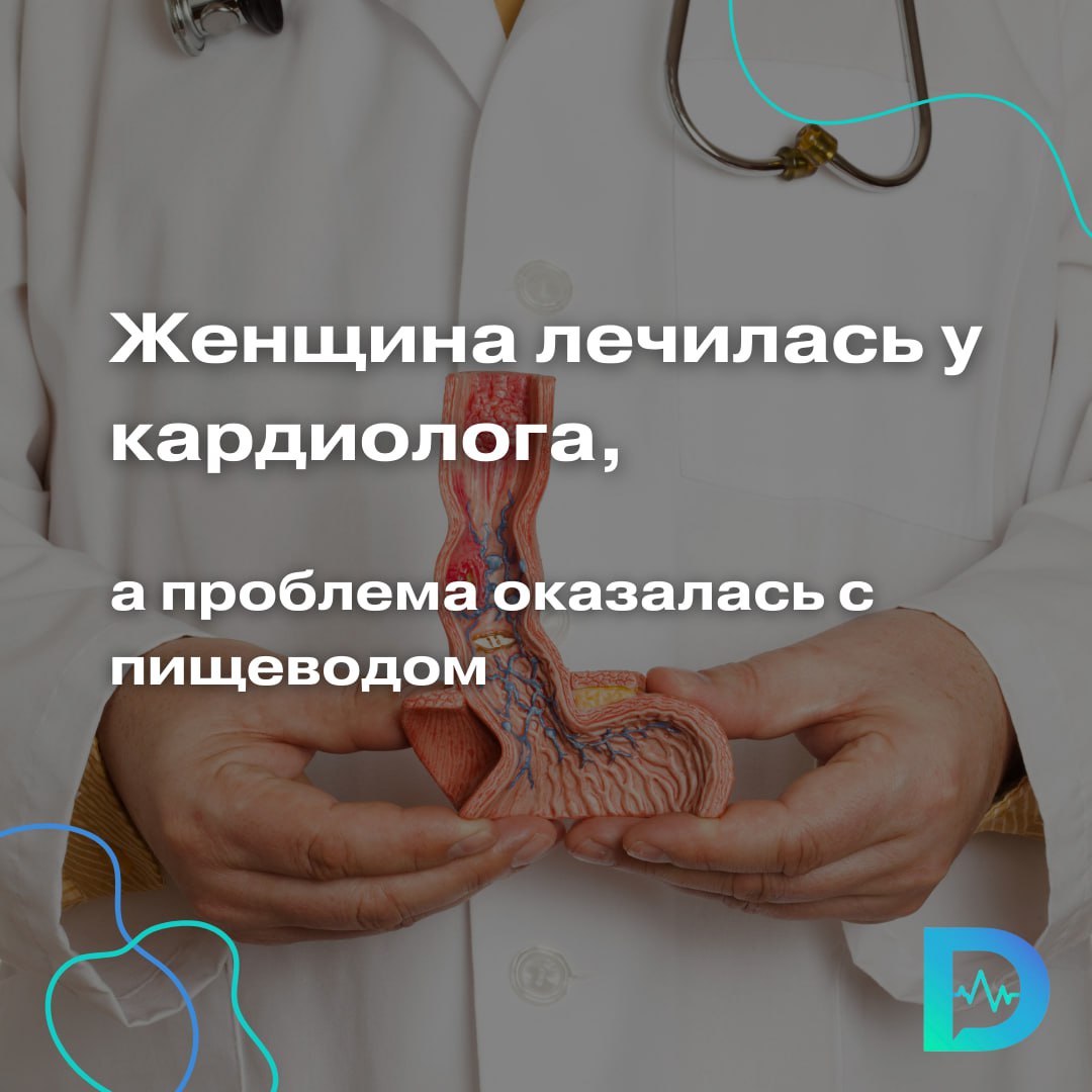 Часто бывает, особенно у женщин, что за желудочными симптомамы скрываются проблемы с сердцем. Об этом мы писали   здесь.  Но иногда бывает и наоборот: жительницу Краснодарского края лечили кардиологи, а проблема оказалась с пищеводом.  Причина недомогания обнаружилась случайно — во время стандартной рентгеноскопии пищевода, желудка и 12-перстной кишки с контрастом. И оказалась она неожиданной как для врачей, так и для самой женщины.  Рентгеноскопия выявила гигантскую грыжу пищеводного отверстия диафрагмы в сочетании с дивертикулом нижней трети пищевода. Эти состояния могут долгое время развиваться бессимптомно или маскироваться под другую патологию, например, сердечную,  — рассказали специалисты краснодарской Краевой клинической больницы № 2 в телеграм-канале стационара.  После диагностики пациентку направили на консультацию к хирургам, а потом госпитализировали на одно из отделений больницы, где она сейчас проходит лечение.    Грыжей пищеводного отверстия диафрагмы называют увеличение в размерах естественного отверстия диафрагмы, через которое пищевод проходит из грудной в брюшную полость. Из-за этого за счёт разницы в давлении из брюшной полости в грудную могут смещаться части органов — например, пищевода или желудка.  Симптомы, по которым можно заподозрить ГПОД, включают: боли и жжение в груди, проблемы с глотанием, изжогу, нарушения сердцебиения.  Причём, эти симптомы обычно усиливаются в положении лёжа или при наклонах.  «Доктор Питер». Доступно и достоверно о здоровье