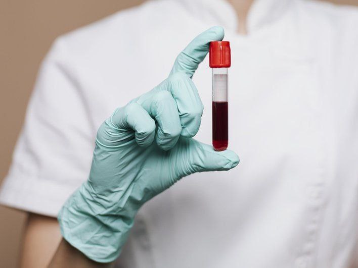 Молодая кровь может омолаживать тело   Немецкие исследователи из Beiersdorf AG установили, что молодая кровь действительно может омолаживать кожу, но только с помощью костного мозга.  Ученые создали 3D-модели кожи и костного мозга и обрабатывали их сывороткой крови людей до 30 и после 60 лет. Оказалось, что молодая кровь сама по себе не работает — нужен сигнал от костного мозга, который запускает выработку омолаживающих белков.  Исследователи обнаружили семь ключевых белков, которые ускоряют деление клеток, стимулируют выработку коллагена и улучшают работу митохондрий  энергостанций клеток .  Пока метод тестировали только в лаборатории, но в будущем он может привести к созданию косметики с усиленным anti-age эффектом, инъекций на основе компонентов костного мозга и персонализированных антивозрастных терапий.